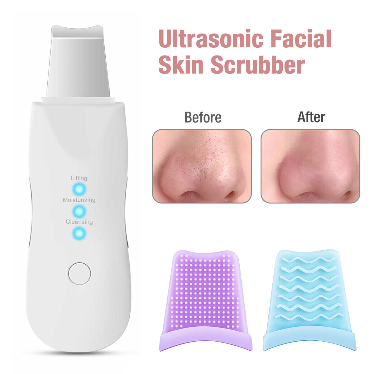 Συσκευή Υπερήχων Ultrasonic Skin Scrubber – Βαθύς Καθαρισμός και Περιποίηση Προσώπου