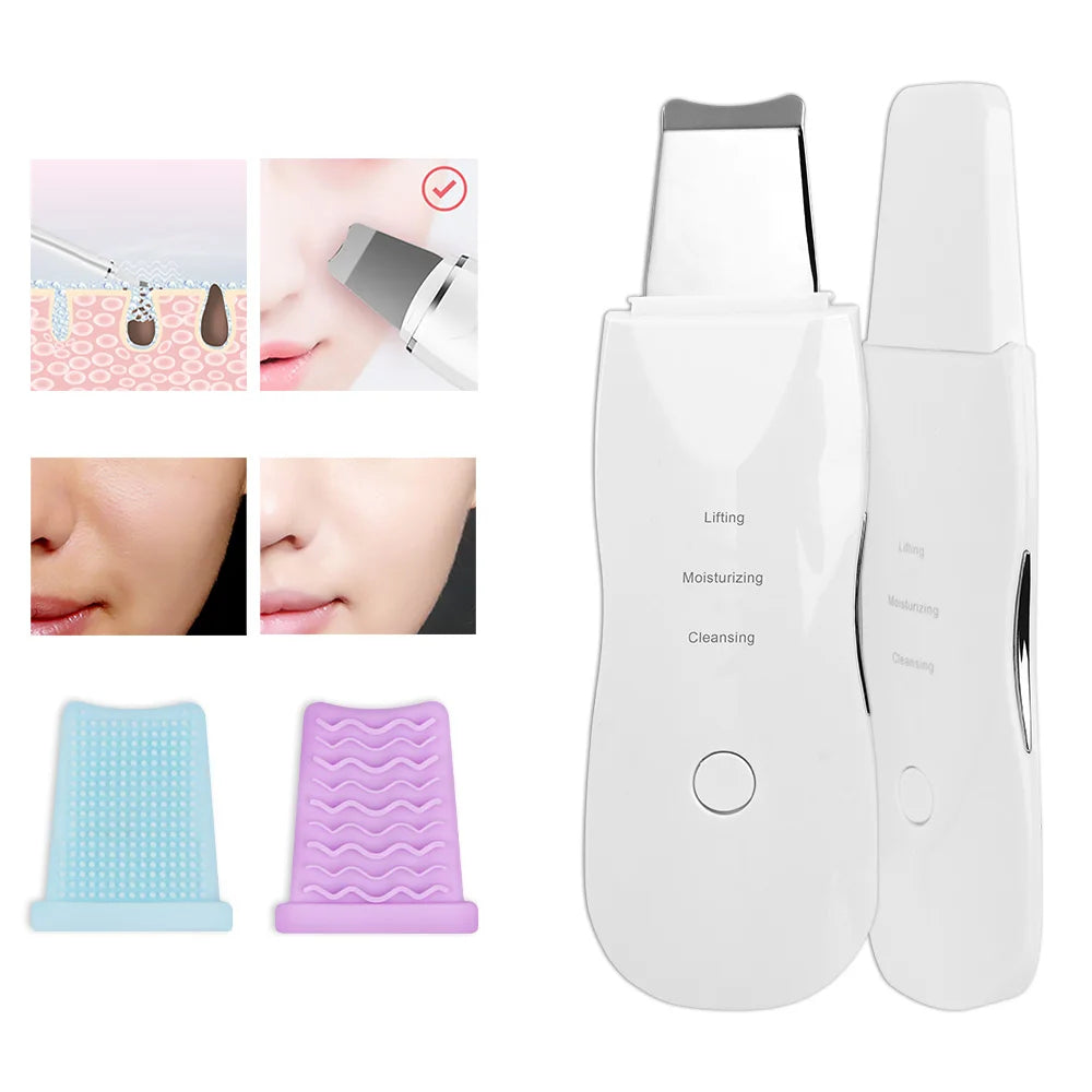 Συσκευή Υπερήχων Ultrasonic Skin Scrubber – Βαθύς Καθαρισμός και Περιποίηση Προσώπου