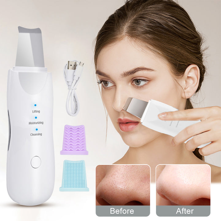 Συσκευή Υπερήχων Ultrasonic Skin Scrubber – Βαθύς Καθαρισμός και Περιποίηση Προσώπου